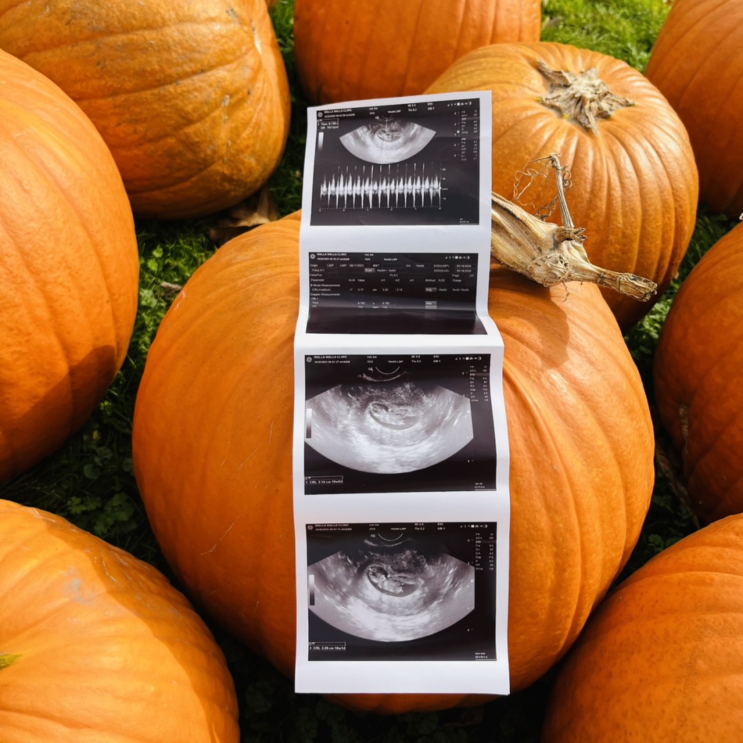 Photo shared by Bianca for their Babylist baby registry.