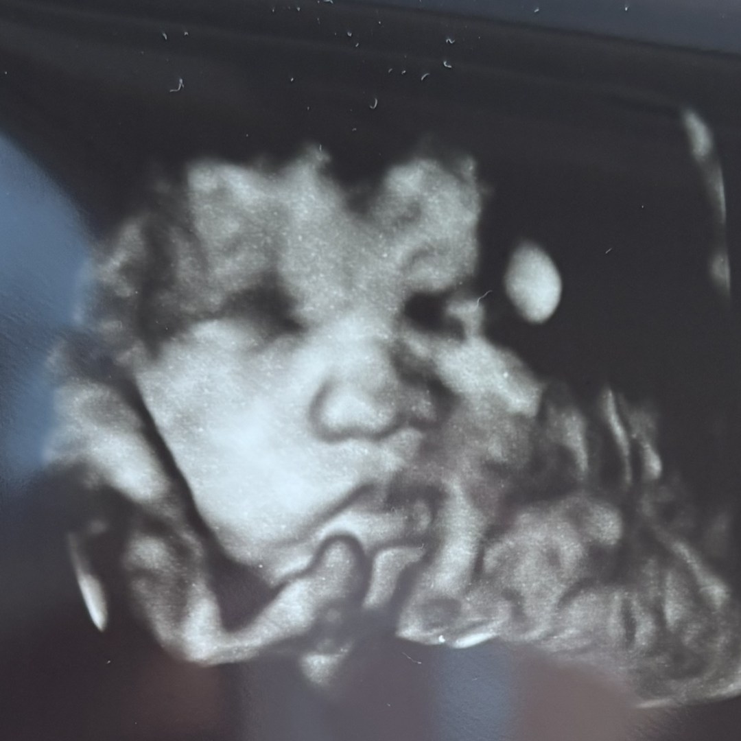 Photo shared by Jordan for their Babylist baby registry.