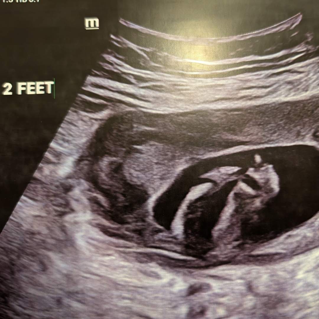 Photo shared by Courtney for their Babylist baby registry.
