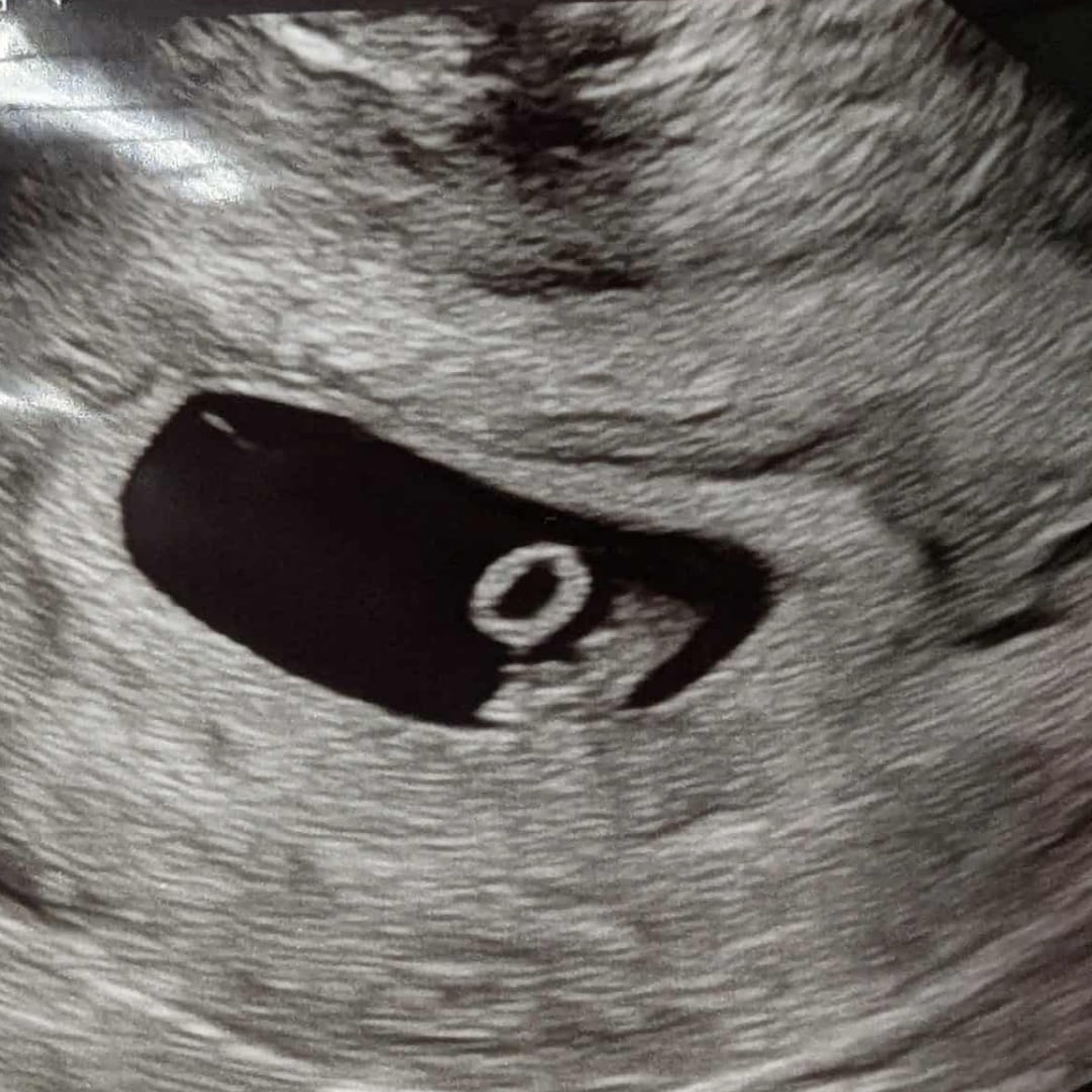 Photo shared by Danesha for their Babylist baby registry.