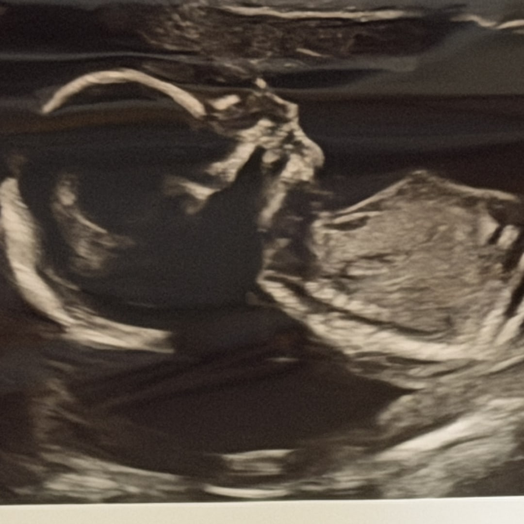 Photo shared by Austin & Margie for their Babylist baby registry.