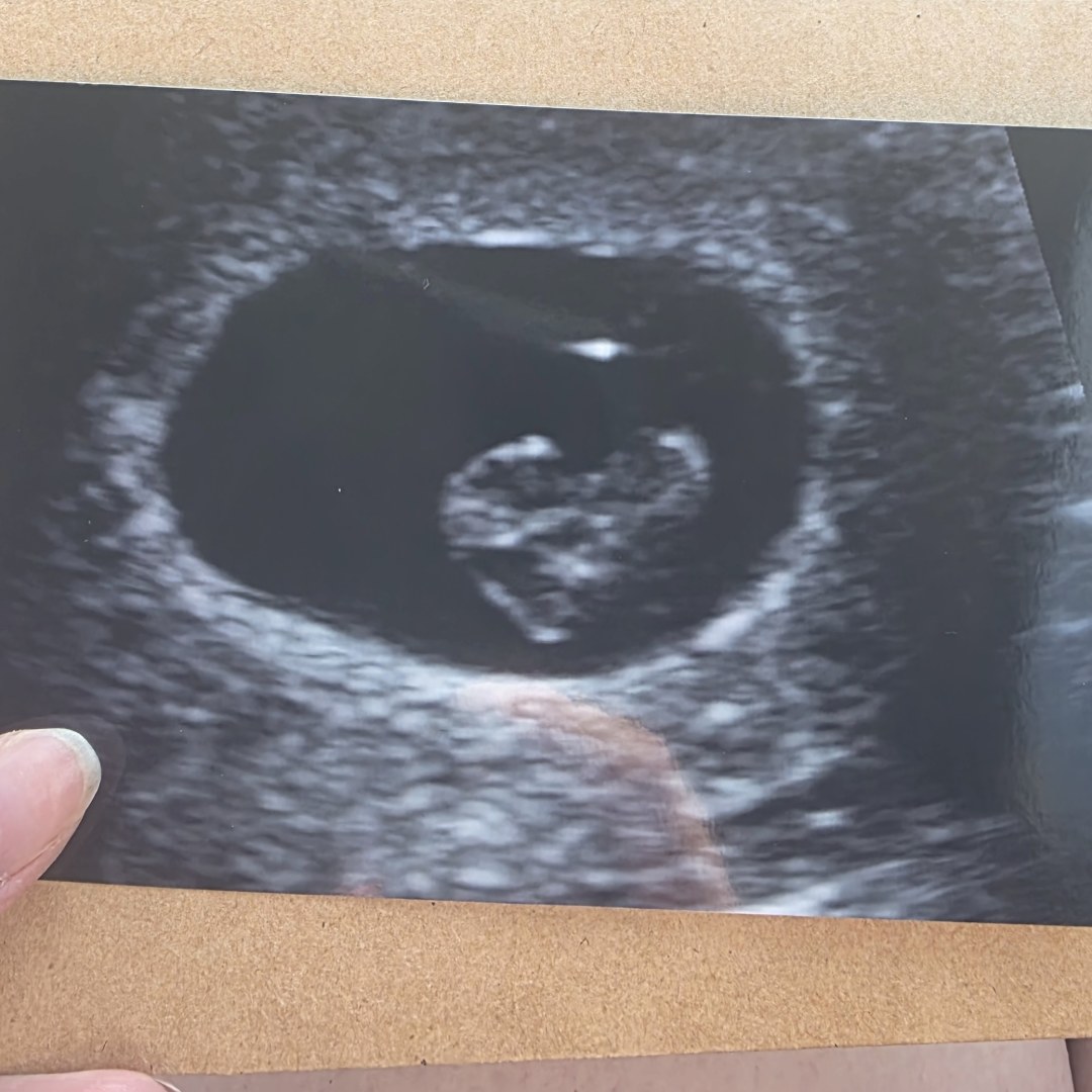 Photo shared by Kaitlin for their Babylist baby registry.