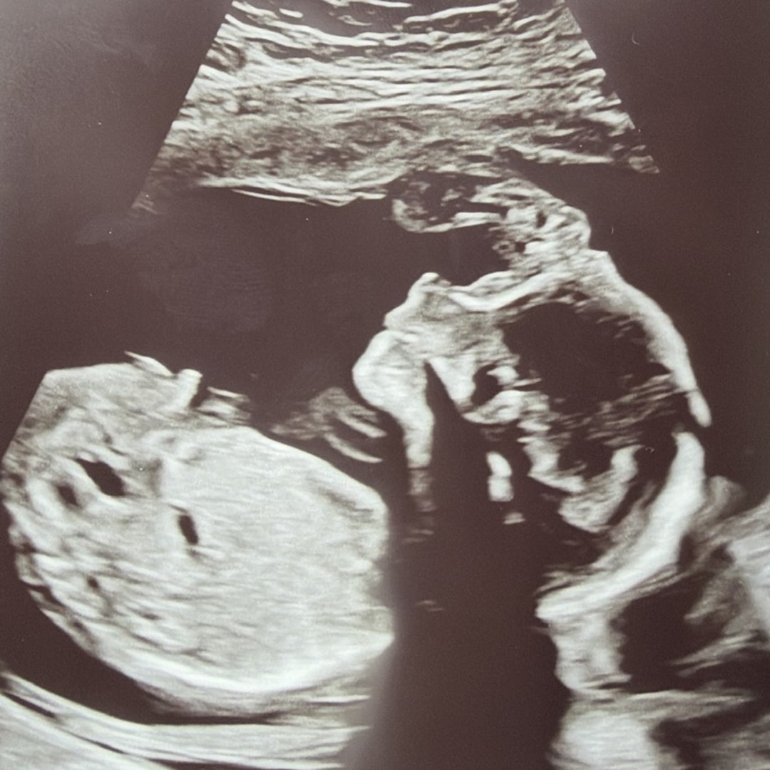 Photo shared by Alyssa for their Babylist baby registry.