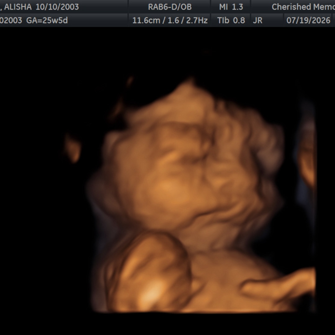Photo shared by Alisha for their Babylist baby registry.