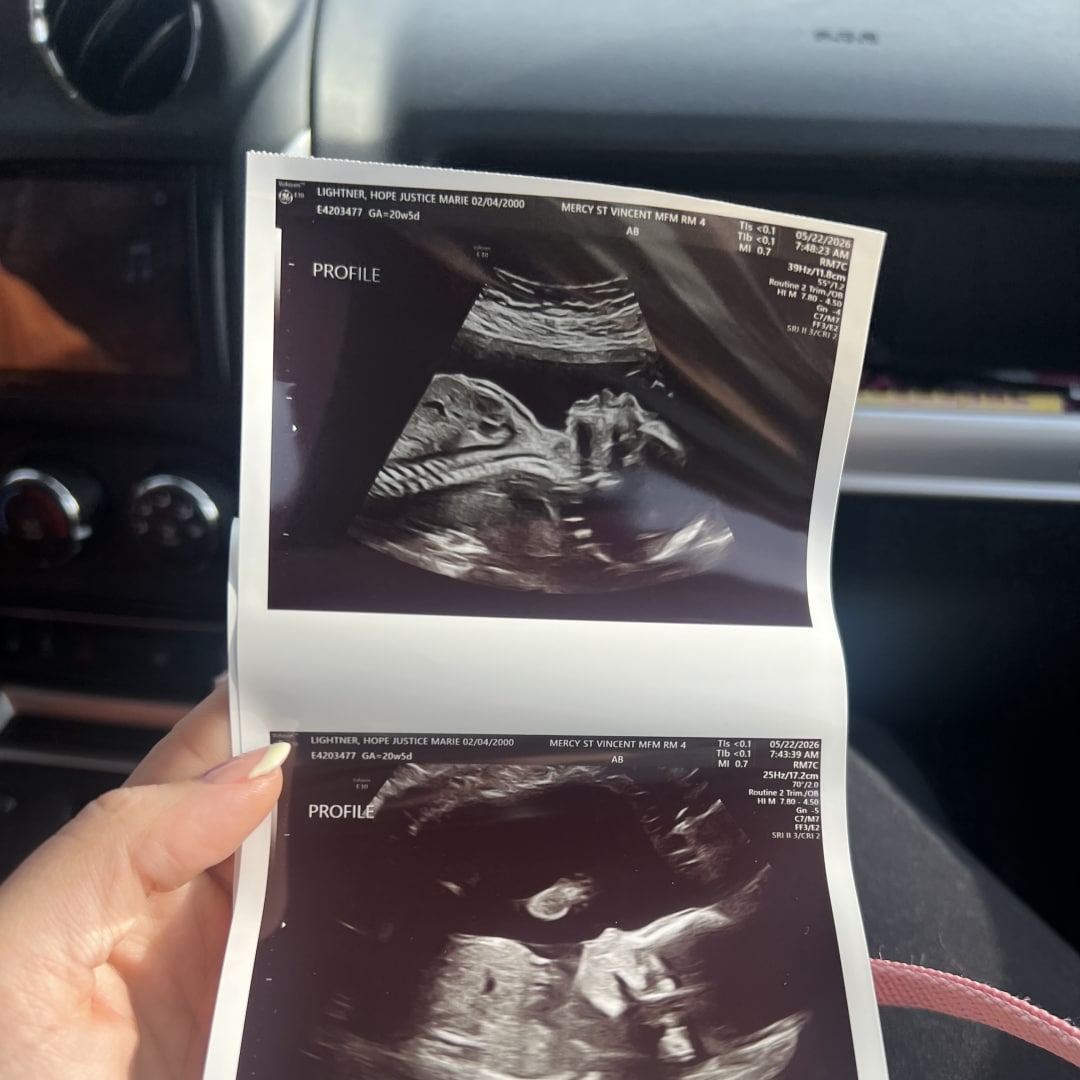 Photo shared by Hope for their Babylist baby registry.