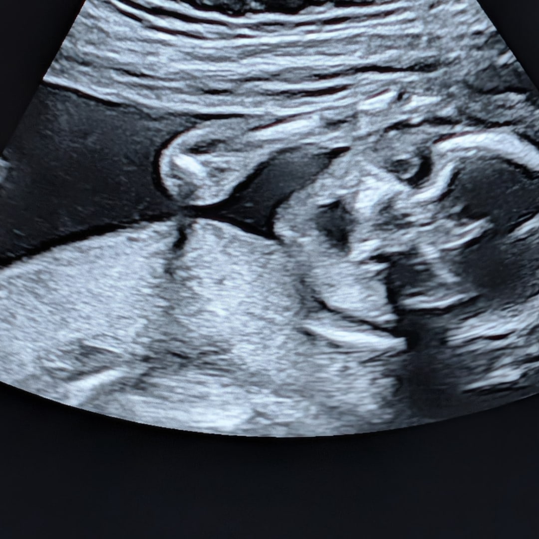 Photo shared by Alexis for their Babylist baby registry.