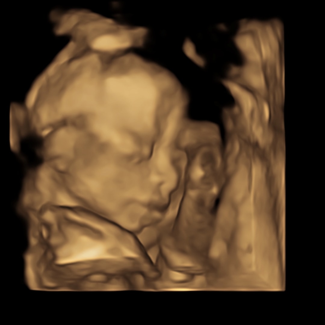Photo shared by Anné for their Babylist baby registry.