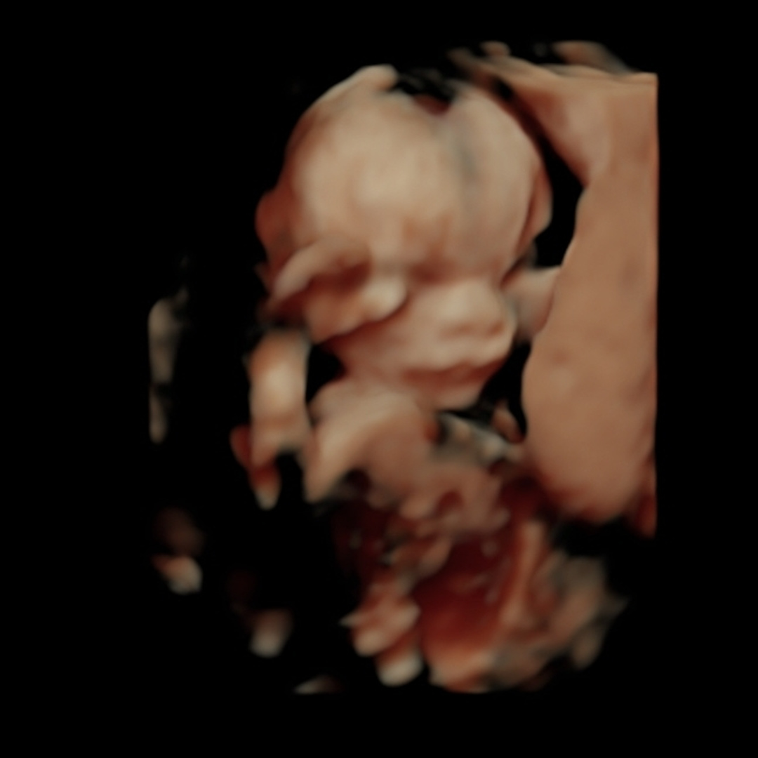 Photo shared by Alexis for their Babylist baby registry.