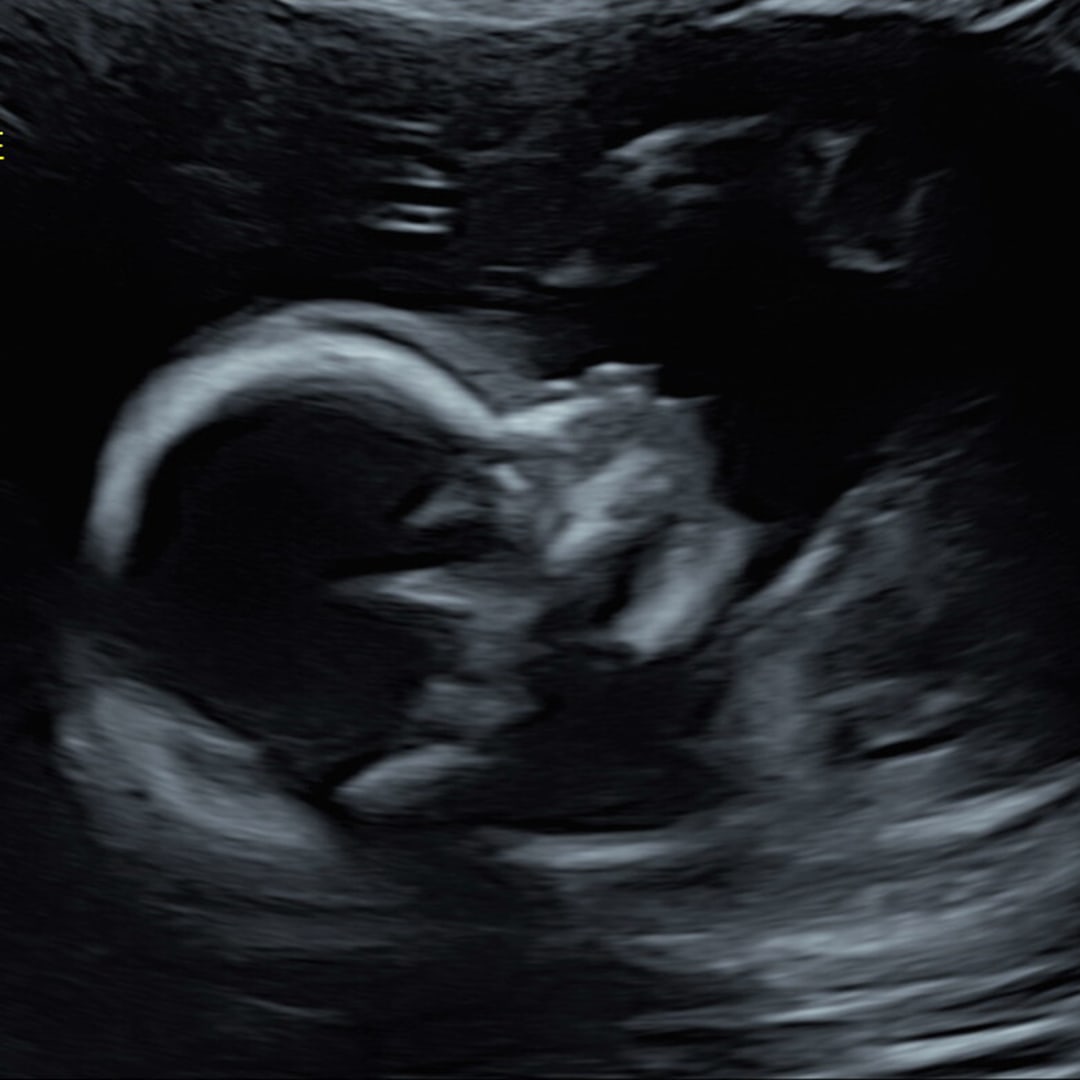 Photo shared by Ashlynn for their Babylist baby registry.