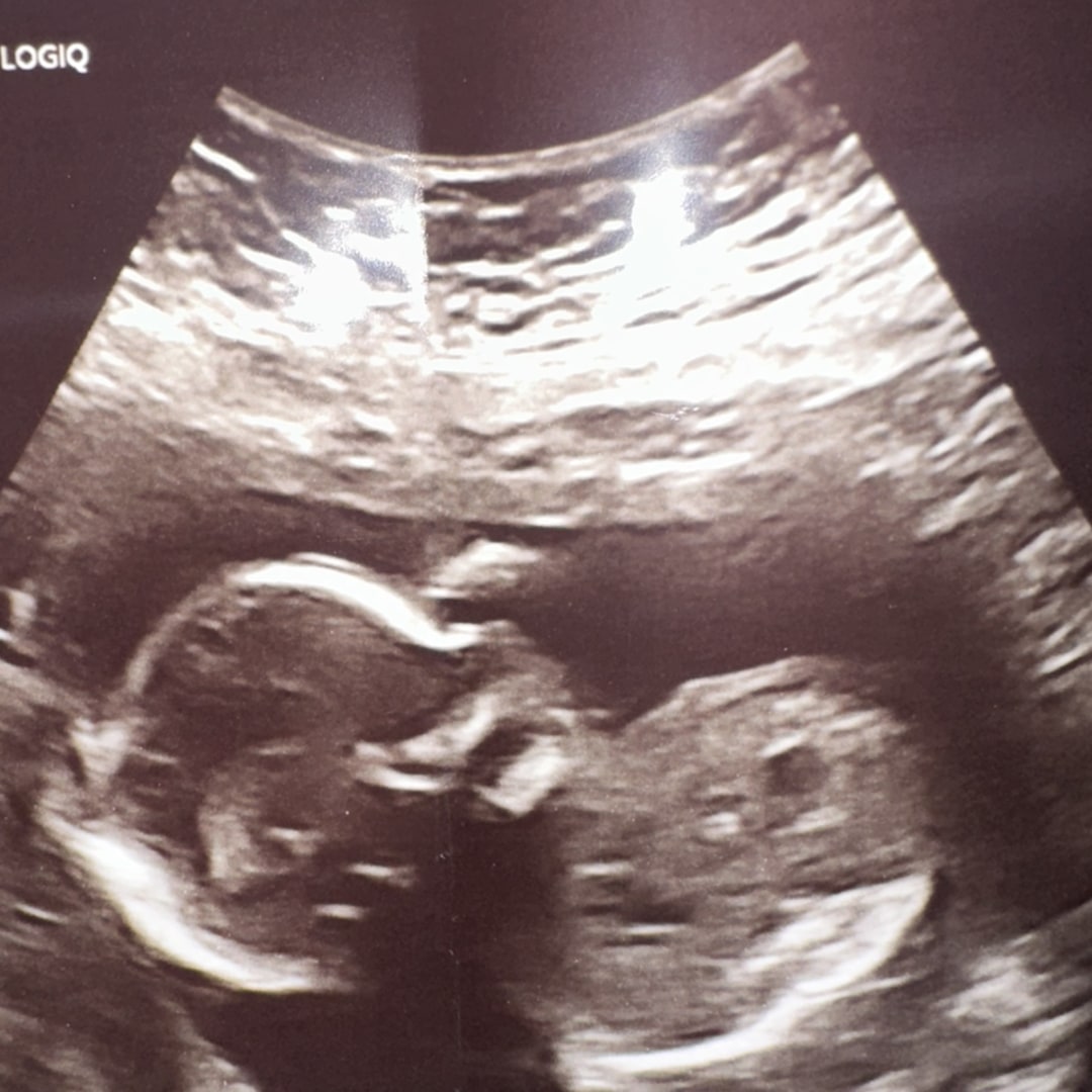 Photo shared by Natalie for their Babylist baby registry.