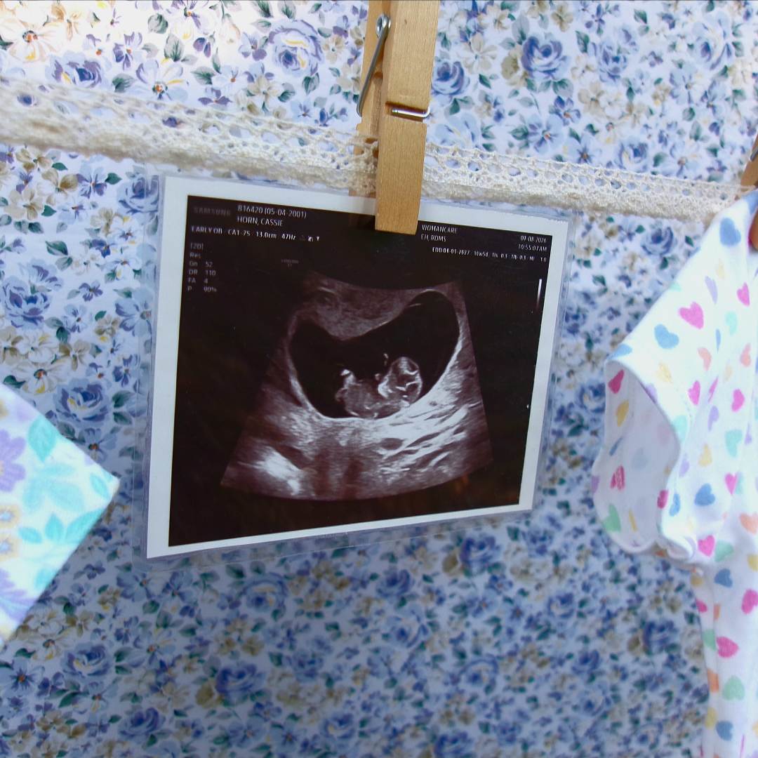 Photo shared by Cassie for their Babylist baby registry.
