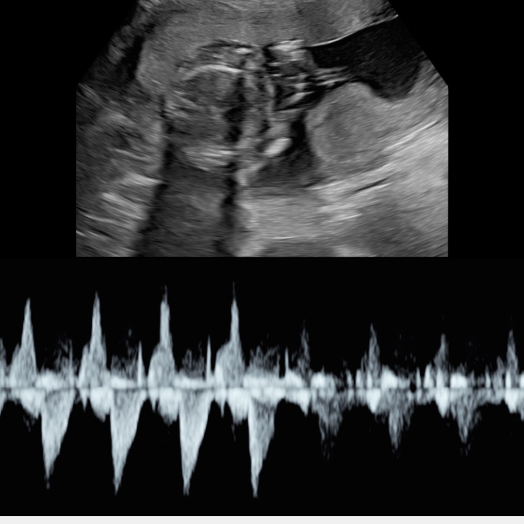 Photo shared by Symantha for their Babylist baby registry.