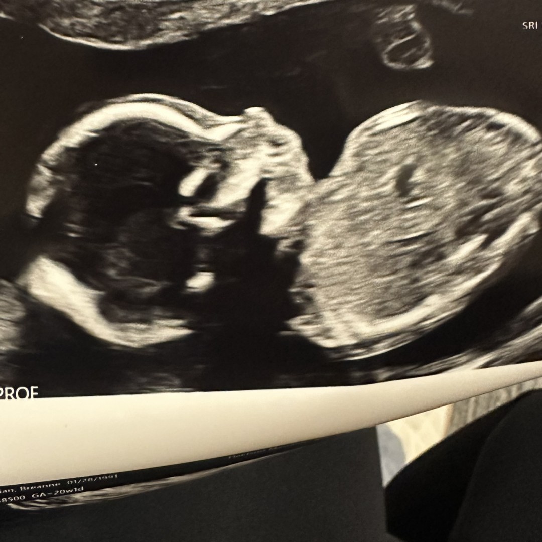 Photo shared by Breanne for their Babylist baby registry.