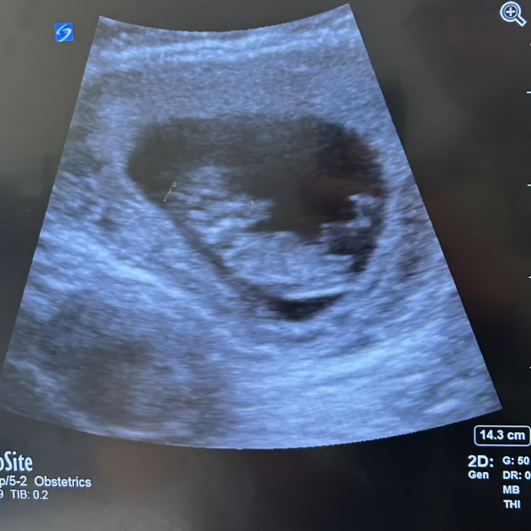 Photo shared by Keely for their Babylist baby registry.