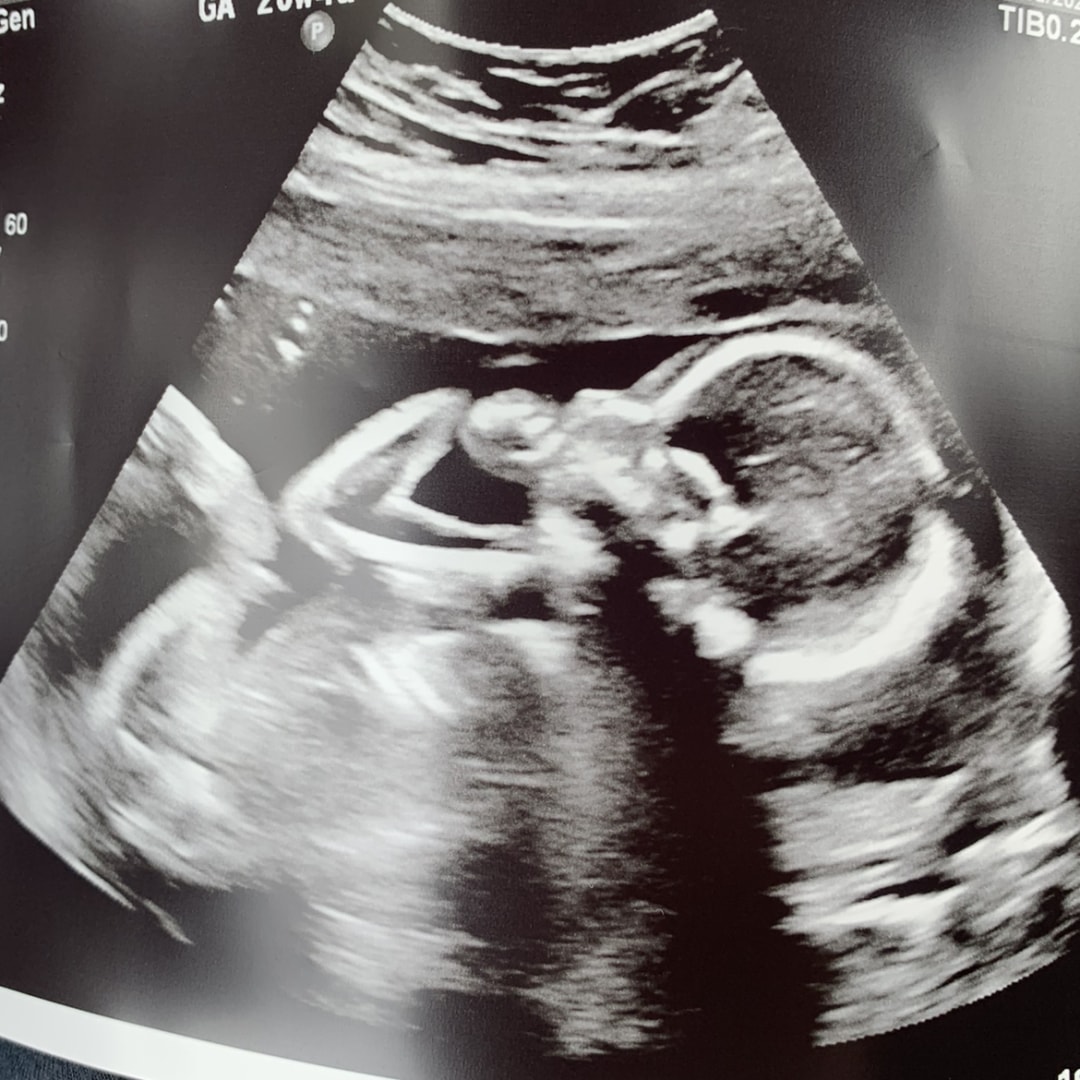 Photo shared by Elyssa for their Babylist baby registry.