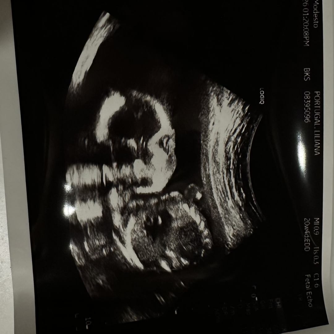 Photo shared by Armand for their Babylist baby registry.