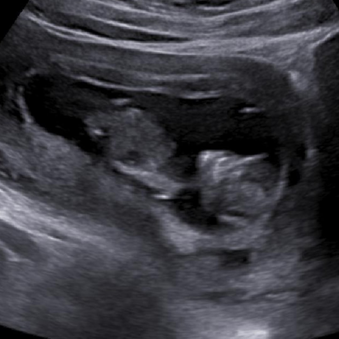 Photo shared by Ashley for their Babylist baby registry.