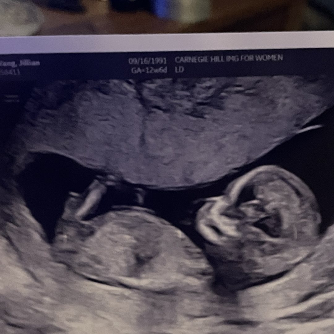 Photo shared by Jill for their Babylist baby registry.