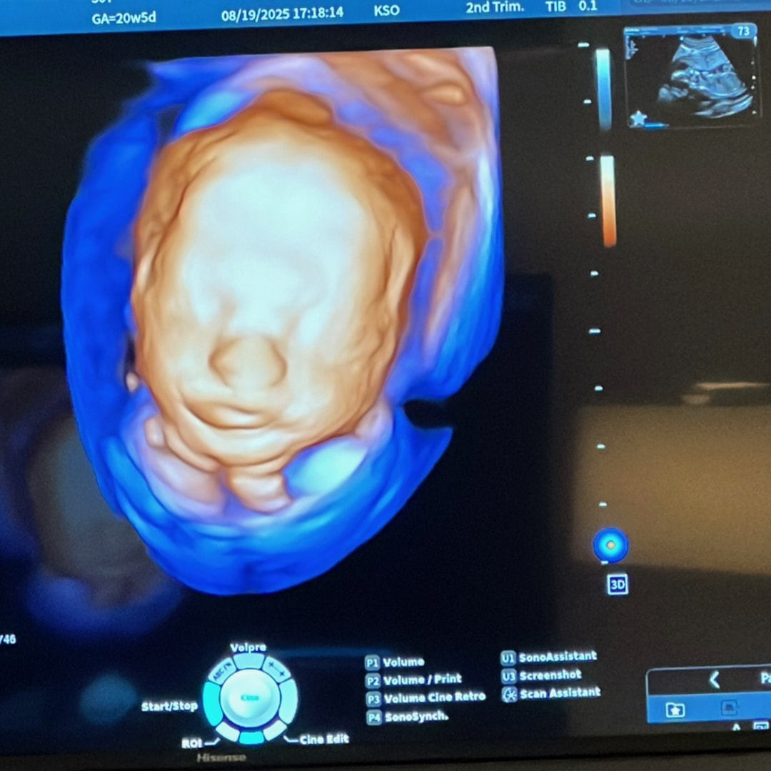 Photo shared by Jackie for their Babylist baby registry.