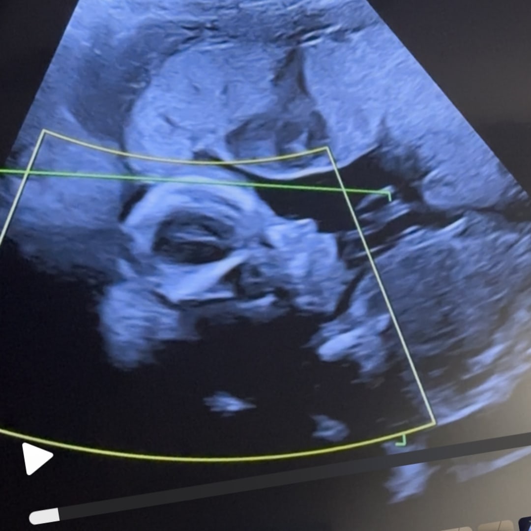 Photo shared by Apple for their Babylist baby registry.