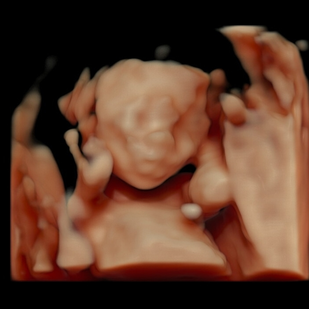 Photo shared by Timonyeh for their Babylist baby registry.