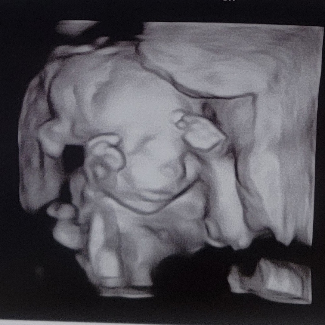 Photo shared by Lindsay for their Babylist baby registry.