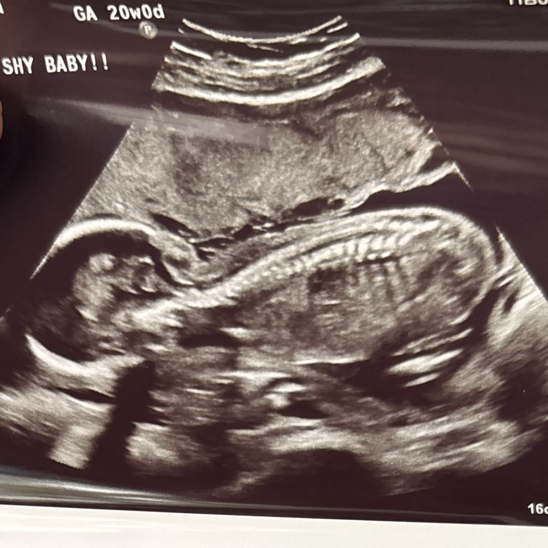 Photo shared by Brooklyn for their Babylist baby registry.
