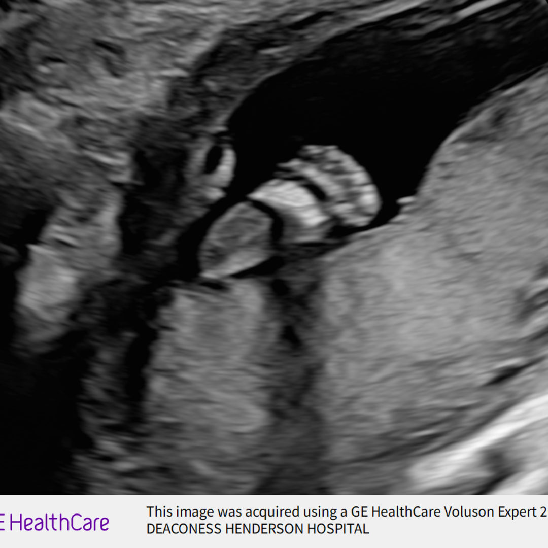 Photo shared by Brianna for their Babylist baby registry.