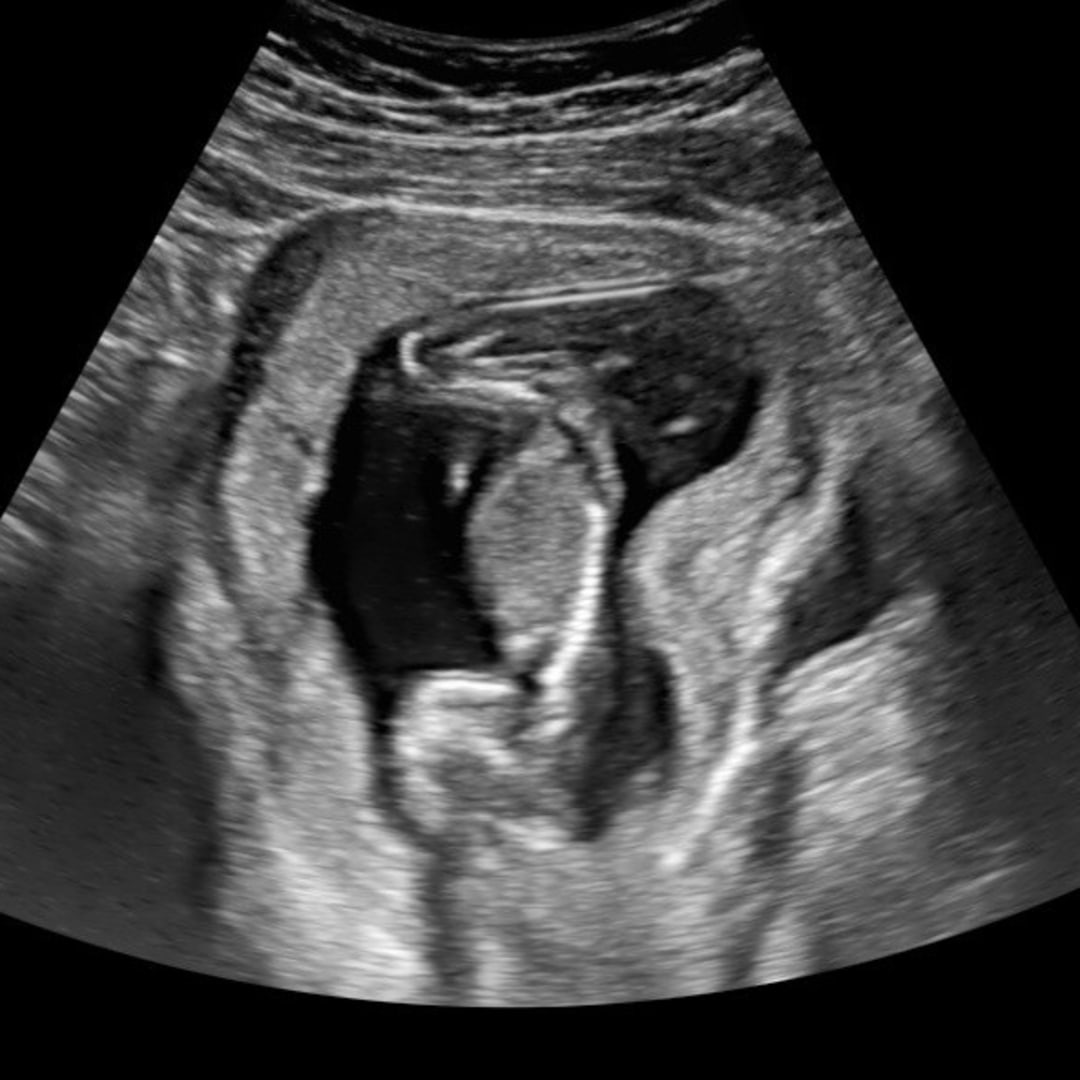 Photo shared by Anaya for their Babylist baby registry.