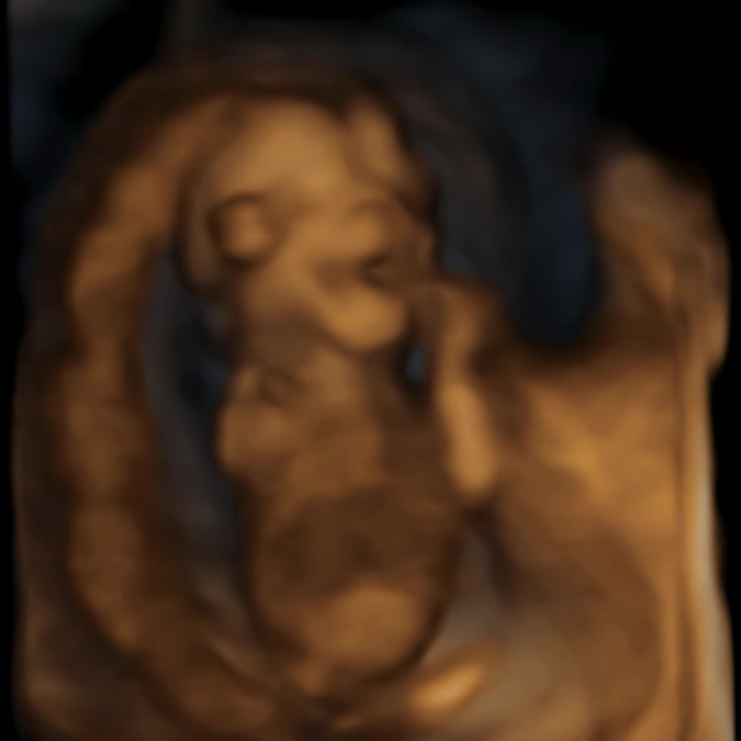 Photo shared by Baley for their Babylist baby registry.