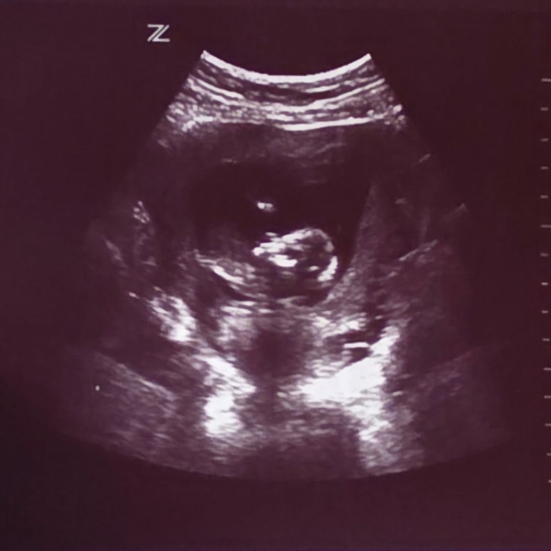 Photo shared by Kyra for their Babylist baby registry.