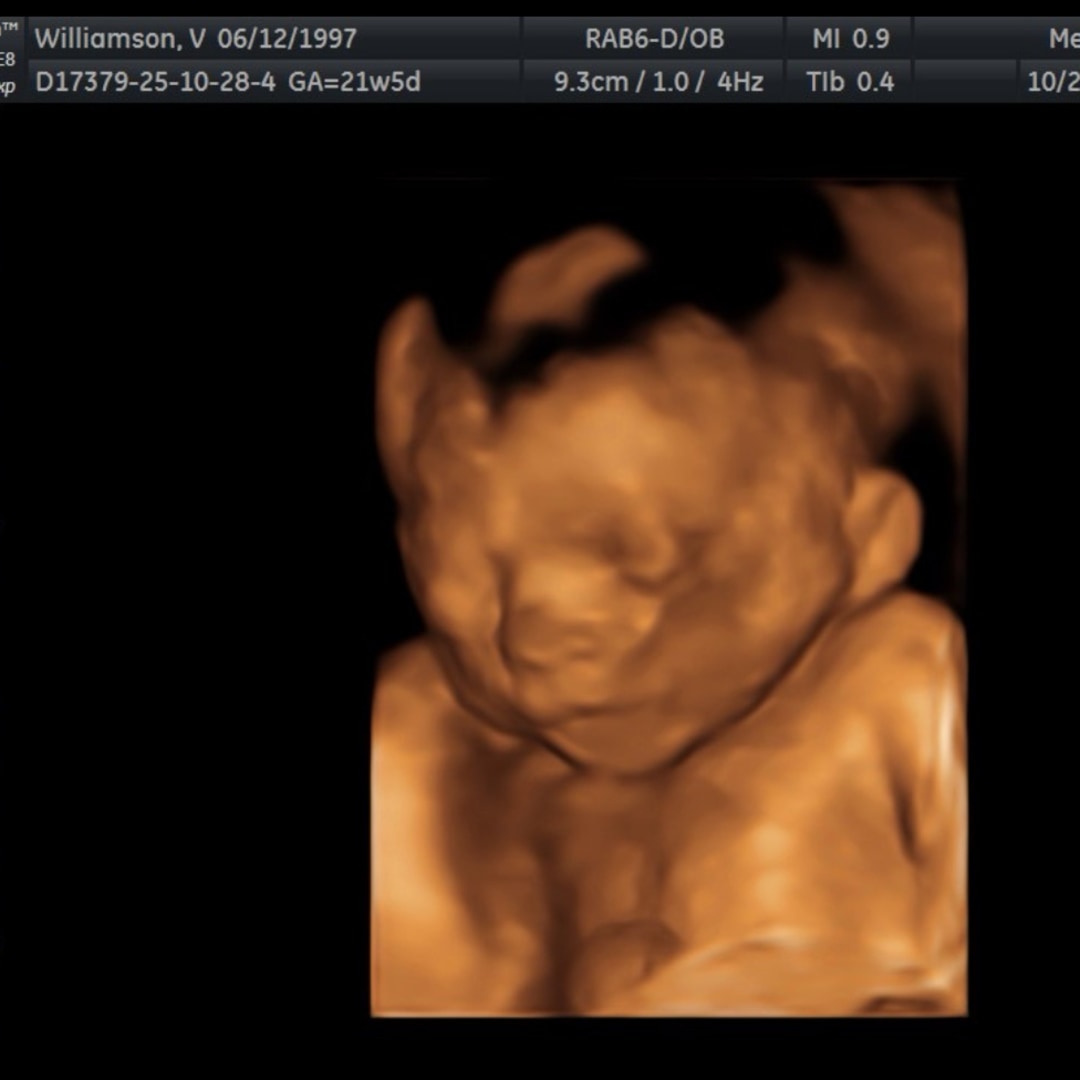 Photo shared by Victoria for their Babylist baby registry.