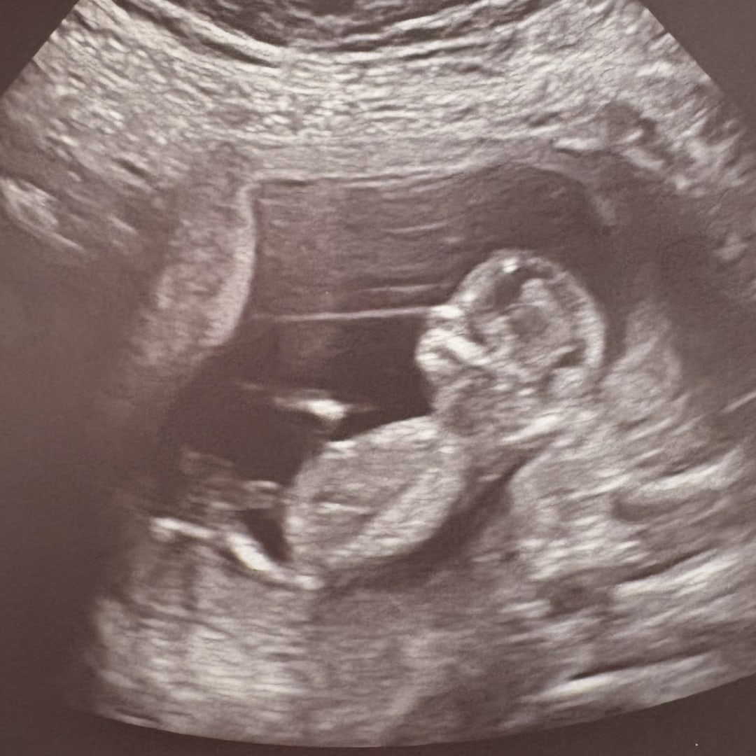 Photo shared by Jess for their Babylist baby registry.