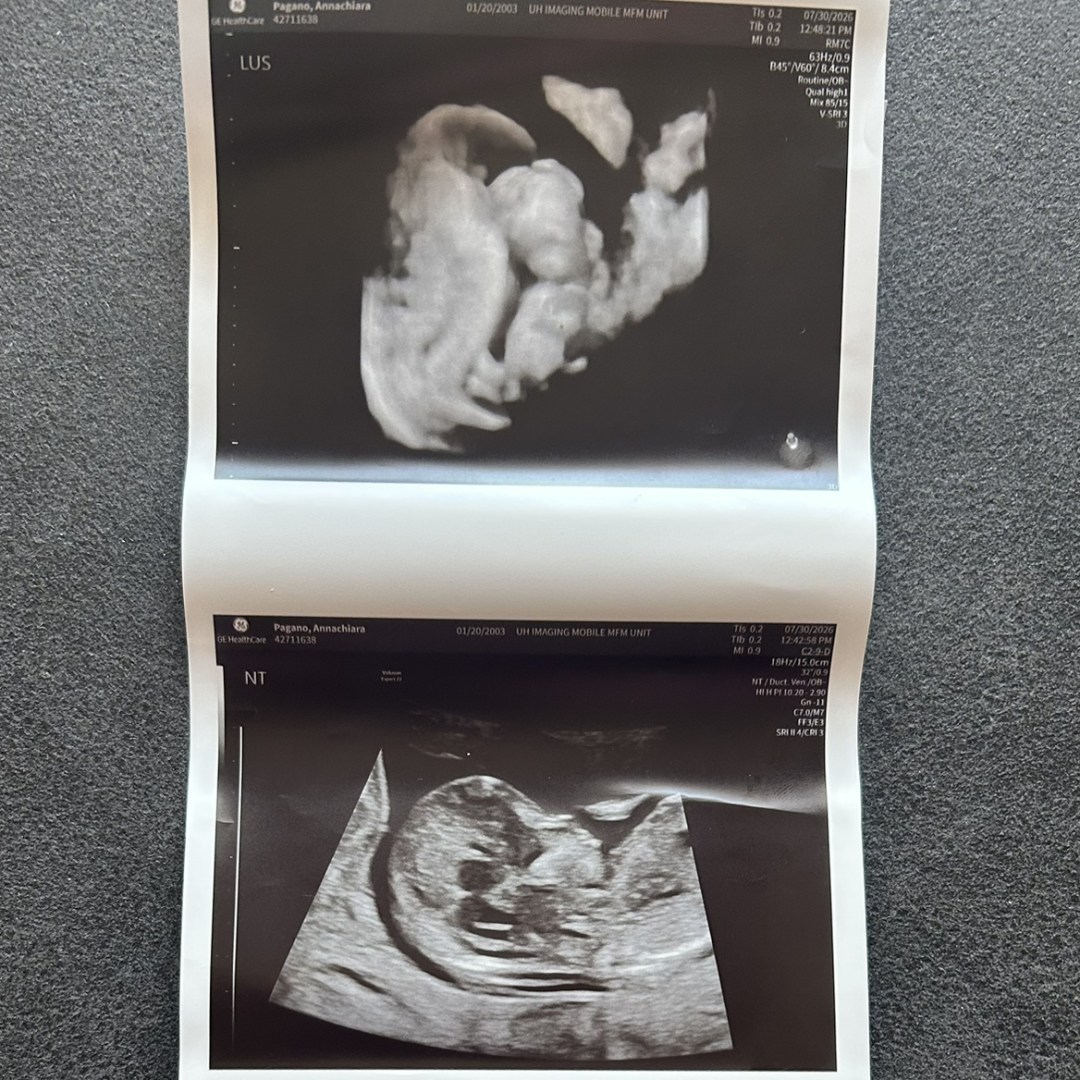Photo shared by Annachiara for their Babylist baby registry.