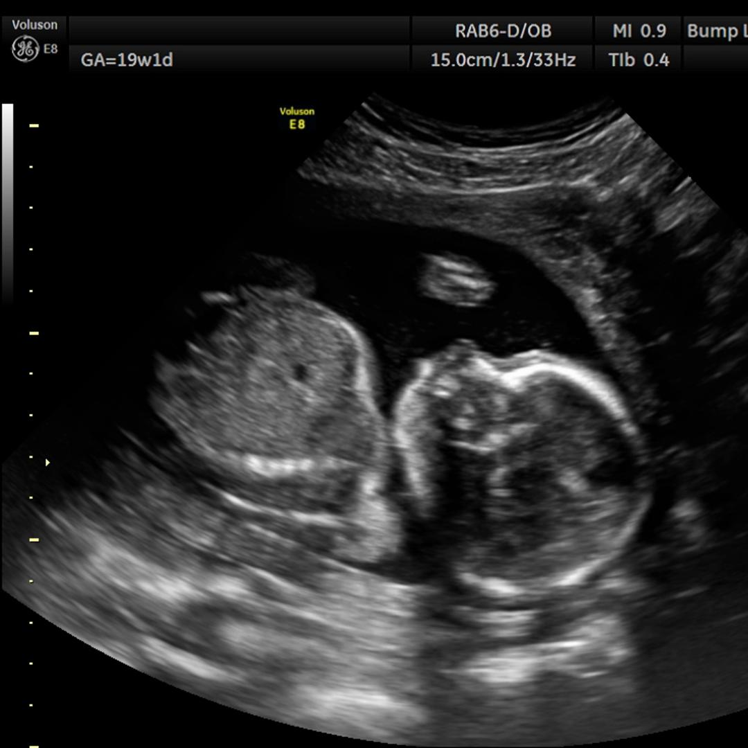 Photo shared by Rebecca for their Babylist baby registry.