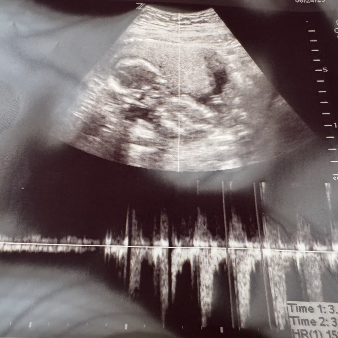 Photo shared by Gabriella for their Babylist baby registry.