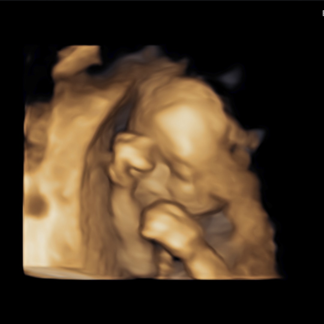 Photo shared by Bailey for their Babylist baby registry.