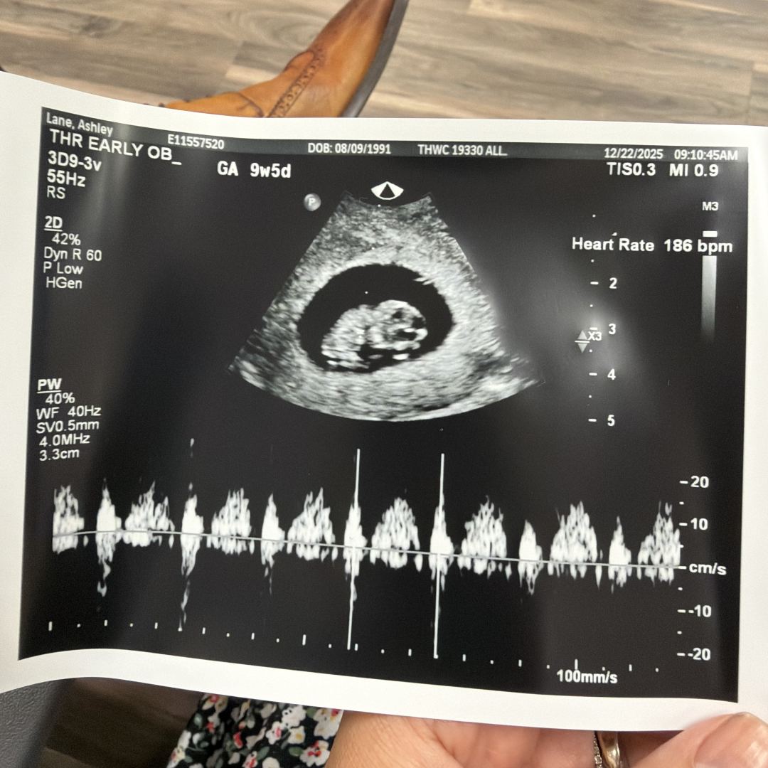 Photo shared by Ashley for their Babylist baby registry.
