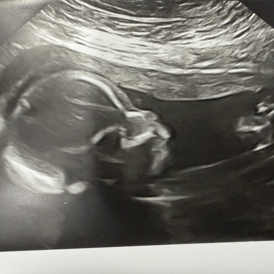 Photo shared by Jamie for their Babylist baby registry.