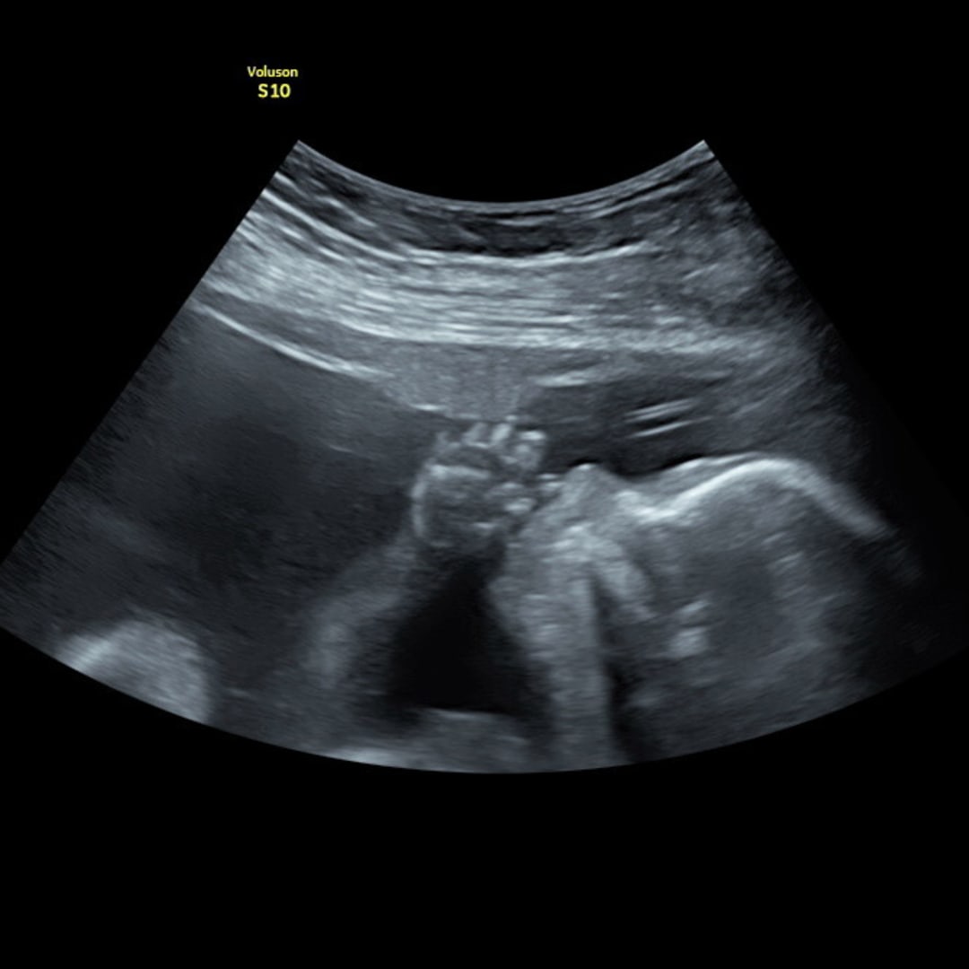 Photo shared by Andrea for their Babylist baby registry.