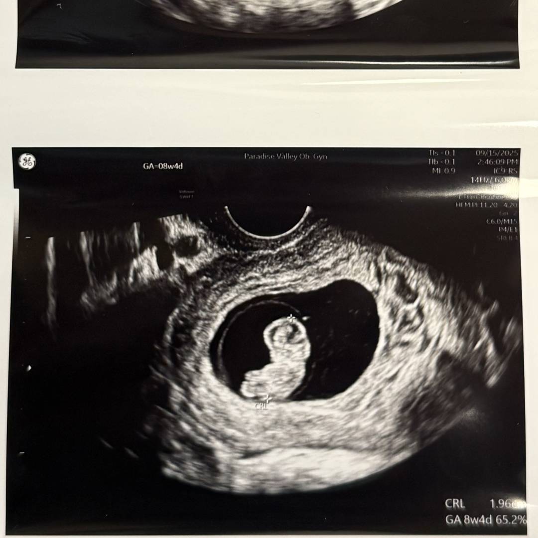 Photo shared by Lina for their Babylist baby registry.