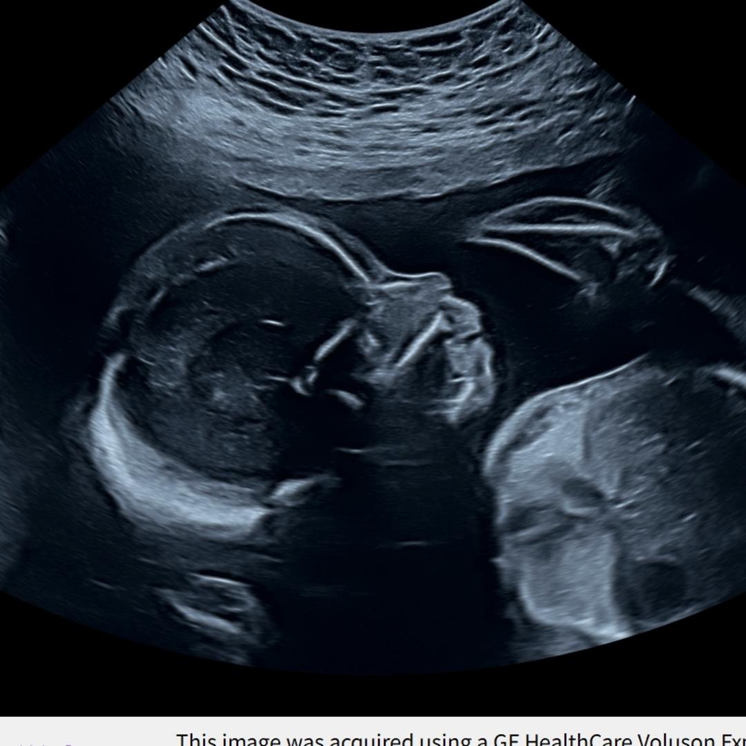 Photo shared by Daryan for their Babylist baby registry.