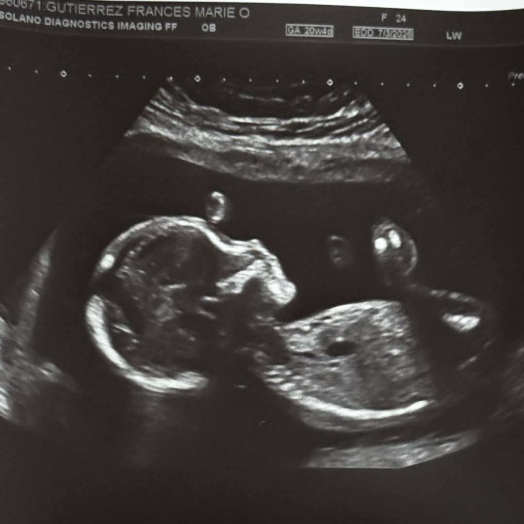 Photo shared by Frances for their Babylist baby registry.