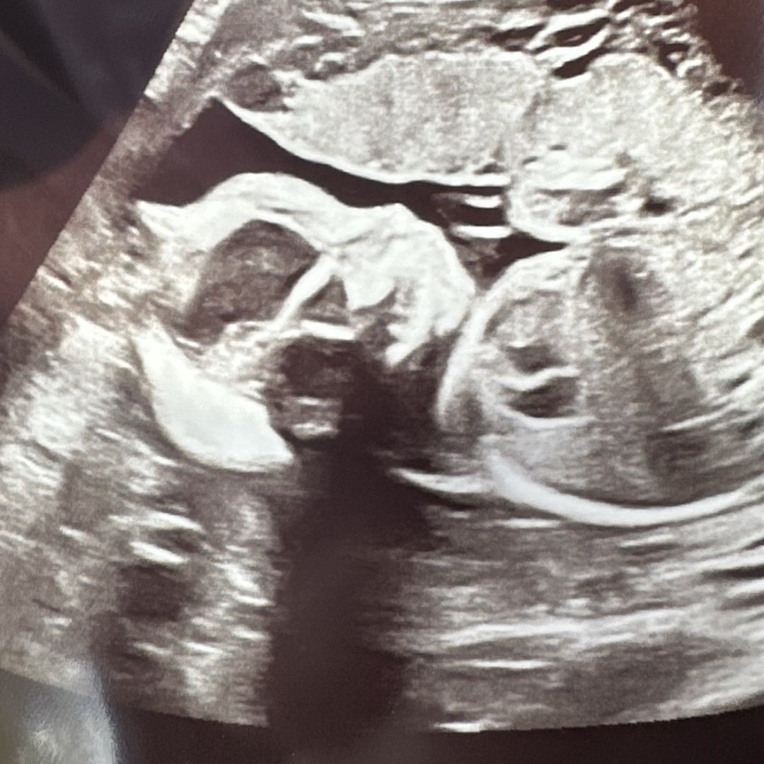 Photo shared by Andrea for their Babylist baby registry.