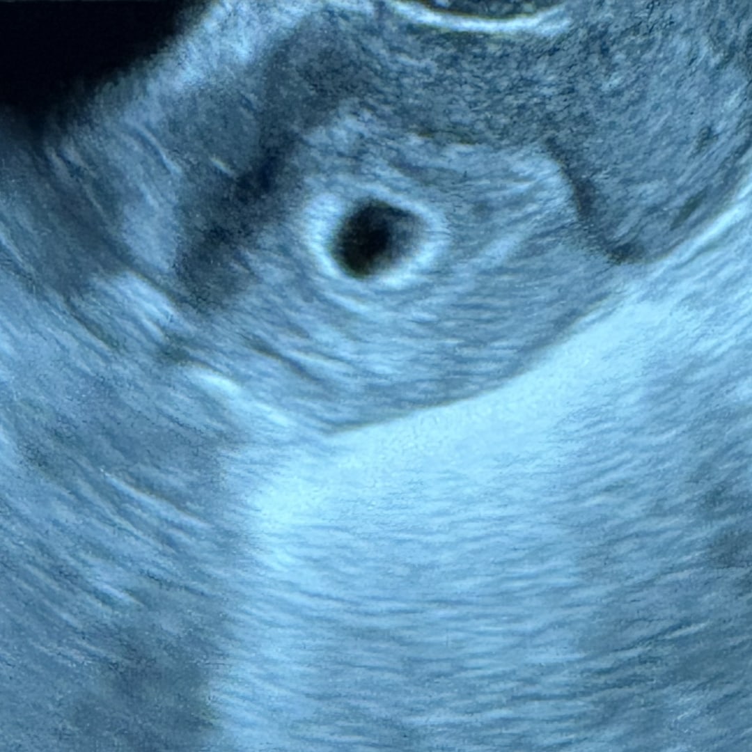 Photo shared by Ashleigh for their Babylist baby registry.