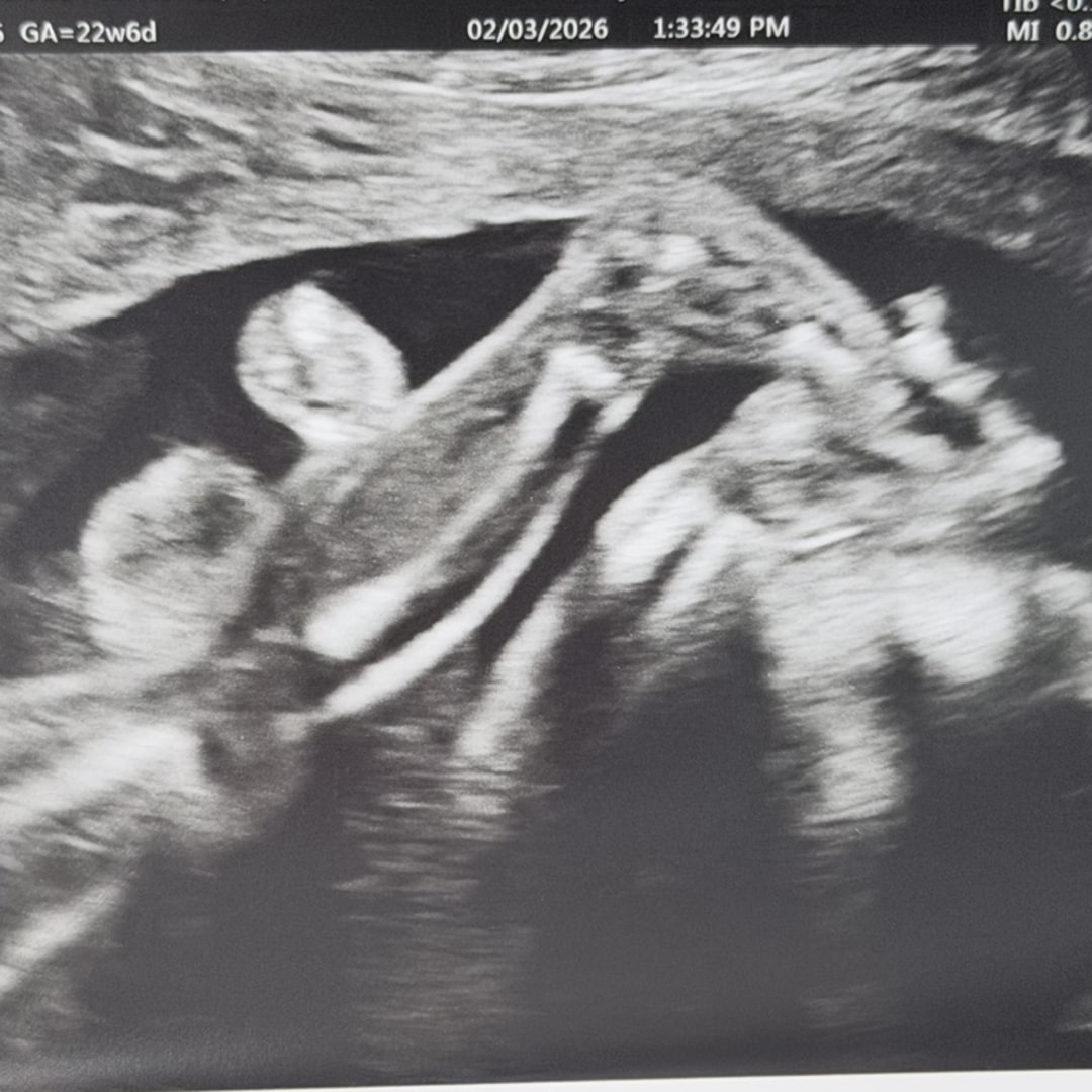 Photo shared by Mikaila for their Babylist baby registry.