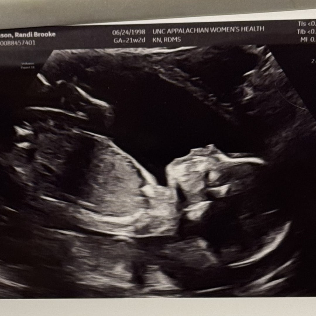 Photo shared by Randi for their Babylist baby registry.