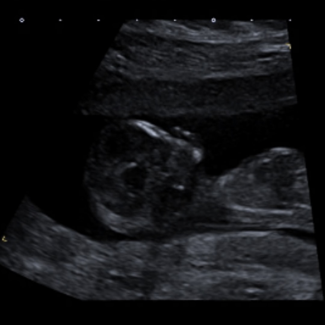 Photo shared by Briony for their Babylist baby registry.