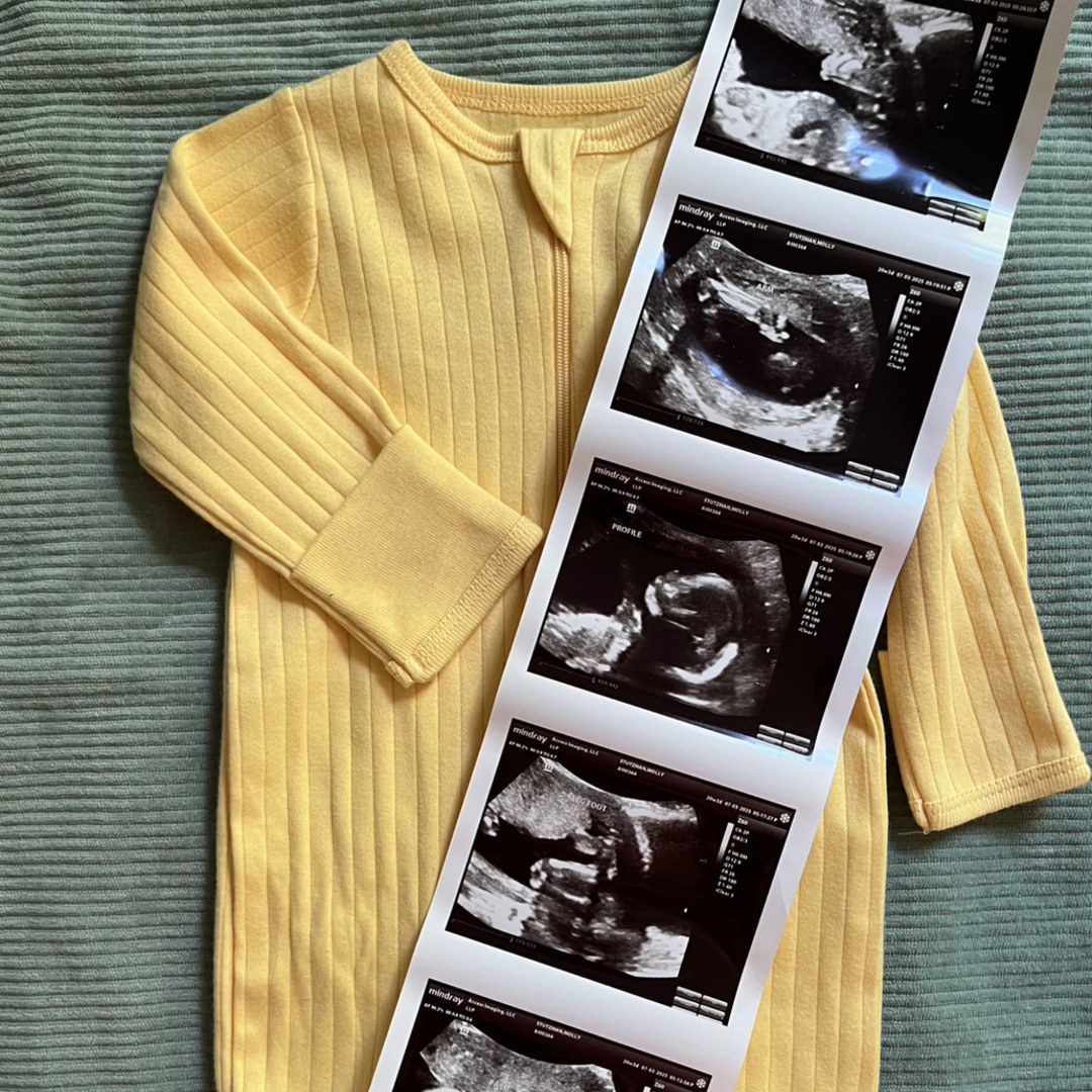 Photo shared by Molly for their Babylist baby registry.