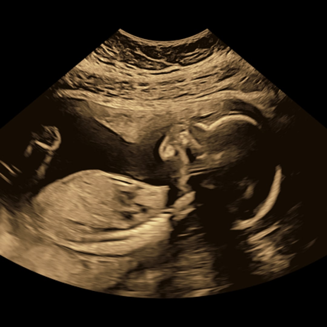 Photo shared by Chasity for their Babylist baby registry.